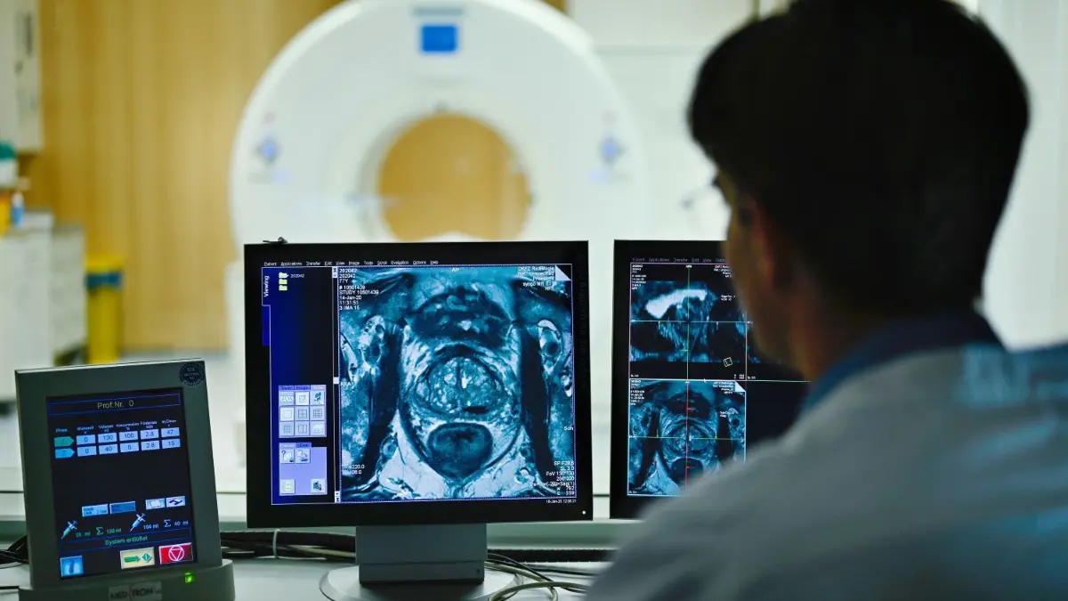 Die Medizin-Diagnostik am Naturwissenschaftlichen und Medizinischen Institut in Reutlingen wird gefördert. ⇥
ARCHIV - 16.01.2020, Baden-Württemberg, Heidelberg: Ein Mitarbeiter betrachtet in einem Kontrollraum des Deutschen Krebsforschungszentrum (DKFZ) auf einem Monitor das Querschnittsbild einer Prostata. Bei einem Presse-Workshop zum Weltkrebstag (4. Februar) wurden am DKFZ neueste Entwicklungen bei bildgebenden Verfahren in Diagnose und Therapie von Krebs vorgestellt. (Zu dpa "EU will Krebs den Kampf ansagen") Foto: Uwe Anspach/dpa +++ dpa-Bildfunk +++ | Verwendung weltweit
