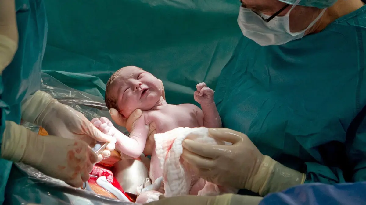 Ein Baby wird in einer Frauenklinik geboren. Nicht immer können die Eltern entscheiden, ob sie eine natürliche Geburt oder einen Kaiserschnitt wollen. Doch was hat die Form der Geburt mit dem Stillen zu tun? (Symbolfoto)
Der Oberarzt der Erlanger Frauenklinik, Mathias Winkler, hält am 12.12.2012 im Kreißsaal der Frauenklinik in Erlangen (Bayern) die kleine Helena Elisa in den Händen. Das Baby kam per Kaiserschnitt um 12 Uhr 12 zur Welt. Foto: Daniel Karmann/dpa +++(c) dpa - Bildfunk+++