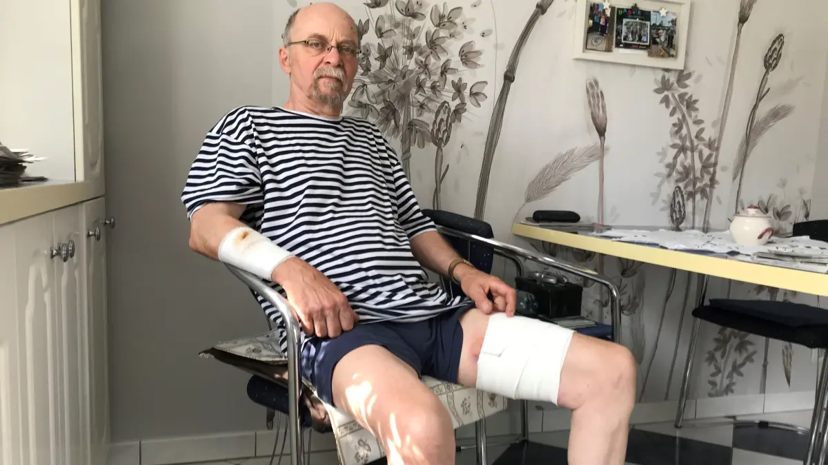Lawitz. Reiner Ziarno (67) sitzt mit schweren Bisswunden in seiner Küche. Am 25.05.2024 ist er beim Angeln an den Kiesgruben nahe Eisenhüttenstadt von einem Kampfhund angegriffen worden. Foto vom 27.05.2024. Foto: Frank Groneberg