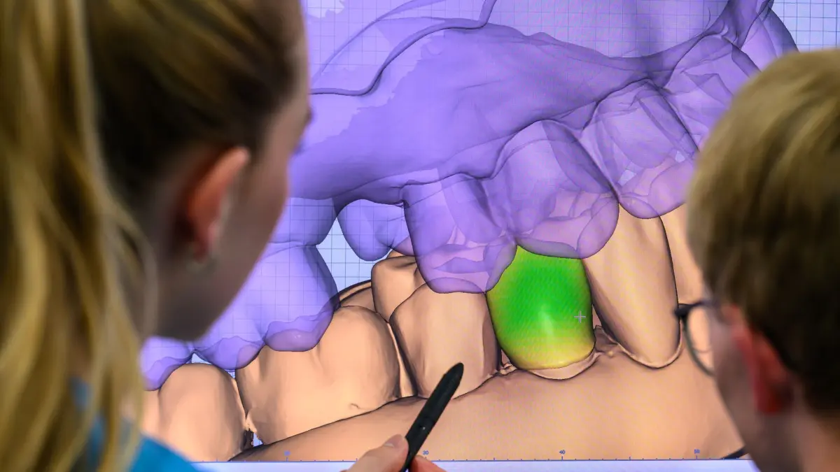 Digitalisierung des Zahnmedizin-Studiums an der Uni Halle: ARCHIV - 27.08.2025, Sachsen-Anhalt, Halle (Saale): Im neuen Simulationssaal der Universitätsmedizin Halle/Saale wird eine Zahnkrone digital konstruiert. In einem eigens umgebauten Bereich stehen nun moderne Arbeitsplätze und spezielle Mundraum-Scanner bereit, um neue prothetische Behandlungsverfahren an realitätsnahen Modellen zu üben. So sehen die 3D-Modelle der Gebisse aus. (zu dpa: «Stipendien sollen zahnmedizinische Versorgung verbessern») Foto: Hendrik Schmidt/dpa +++ dpa-Bildfunk +++