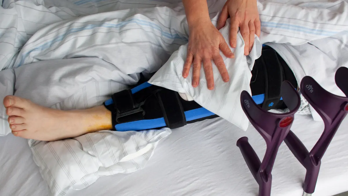 Auf der Chirurgischen Abteilung des Klinikums in Frankfurt (Oder) legt am Montag (08.02.2010) eine Krankenschwester eine Kühlpackung auf das Knie einer Patientin, die vor wenigen Tagen auf einem vereisten Gehweg ausgerutscht war und sich dabei die Kniescheibe gebrochen hatte. Immer mehr Menschen verletzen sich bei Unfällen auf vereisten, schlech...+ Mehr lesenService+++ dpa-Bildfunk +++Aufnahmedatum08.02.2010Bildnachweispicture alliance / dpa | Patrick PleulBesondere Hinweise-ReleaseModel release nicht verfügbarVerwendungZur redaktionellen Verwendung. Nicht redaktionelle Verwendung nach Absprache. Etwaige Marken- und ggf. weitere Schutzrechte sind zu beachten.Mindesthonorar-Bildgröße47.9 MB | 5178 x 3231 px | 44.69 x 27.88 cm @ 300 DPI