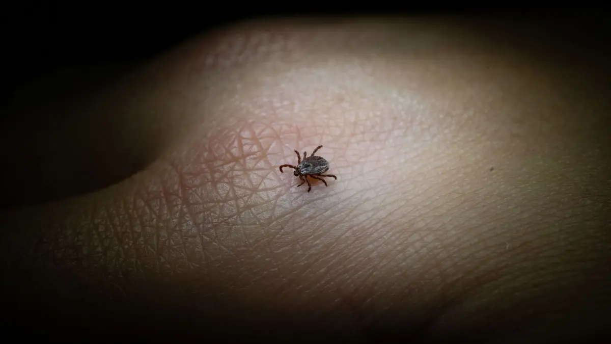 Eine Buntzecke auf einer Hand: ARCHIV - FSME und Borreliose: Diese beiden Erkrankungen können Zecken übertragen, wenn sie selbst mit den Erregern infiziert sind. (zu dpa: «6 Tipps: So schützt man sich vor Zecken, Borreliose und FSME») Foto: Marijan Murat/dpa/dpa-tmn - Honorarfrei nur für Bezieher des dpa-Themendienstes +++ dpa-Themendienst +++