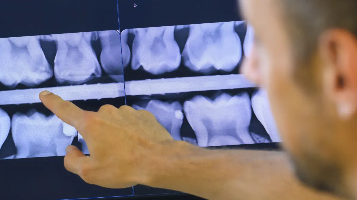 Ein Kinderzahnarzt betrachtet eine Röntgenaufnahme von Milchbackenzähnen eines Kindes in einer Kinderzahnarztpraxis.