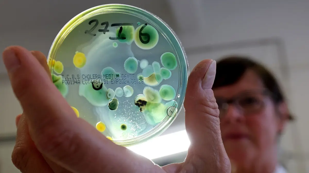 Vibrionen-Nachweis im Landesamt für Gesundheit und Soziales: ARCHIV - Vibrionen sind Bakterien, die weltweit in Meeren, Flussmündungen, Brackwasser, aber auch in Binnenseen vorkommen. (zu dpa: «Baden im Meer: Wie kann man sich vor Vibrionen schützen?») Foto: Bernd Wüstneck/dpa/dpa-tmn - Honorarfrei nur für Bezieher des dpa-Themendienstes +++ dpa-Themendienst +++
