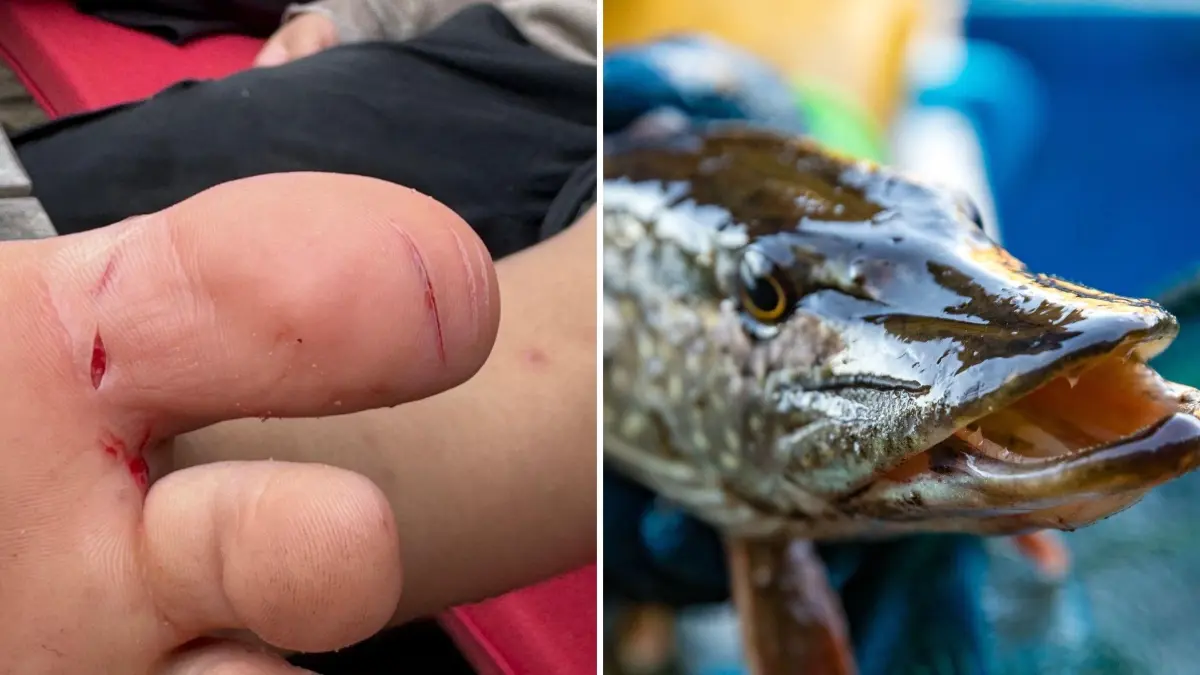 Beim Baden im Gamensee bei Falkenberg hat sich ein Junge im großen Zeh eine Bisswunde zugezogen. Der Übeltäter war vermutlich ein Hecht. Das ist passiert.