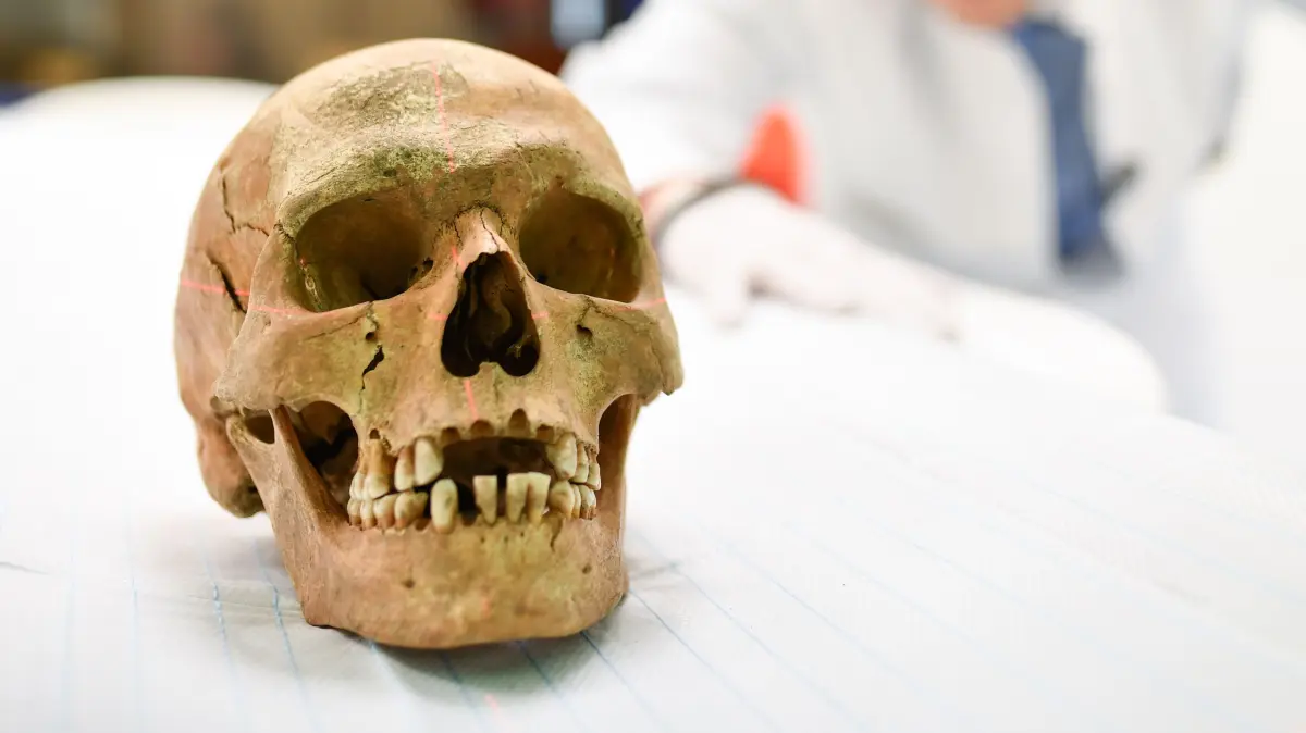 Ein menschlicher Schädel, der auf dem ehemaligen Klostergelände in Lorsch gefunden wurde, wird am 10.08.2016 in Mannheim (Baden-Württemberg) im Universitätsklinikum für den Scan in einem Computertomographen vorbereitet. Das Kloster Lorsch stellt ein anthropologisches Forschungsprojekt vor, bei dem nach Knochenfunden Gesichterrekonstruktionen geplant sind. Foto: Uwe Anspach/dpa ++ +++ dpa-Bildfunk +++